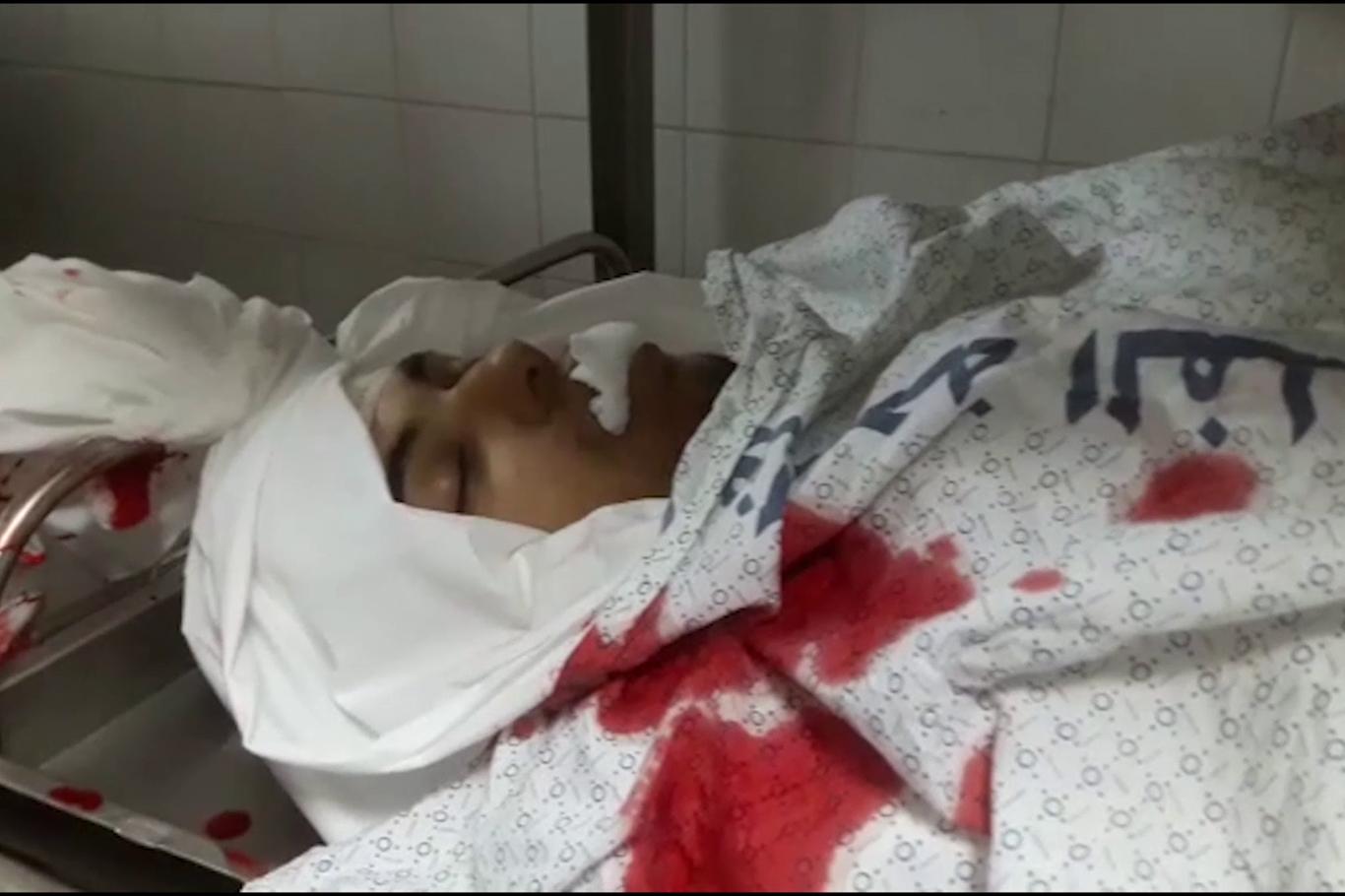 İşgalci çeteler Gazze'de sivilleri vurdu: Bir şehid 22 yaralı
